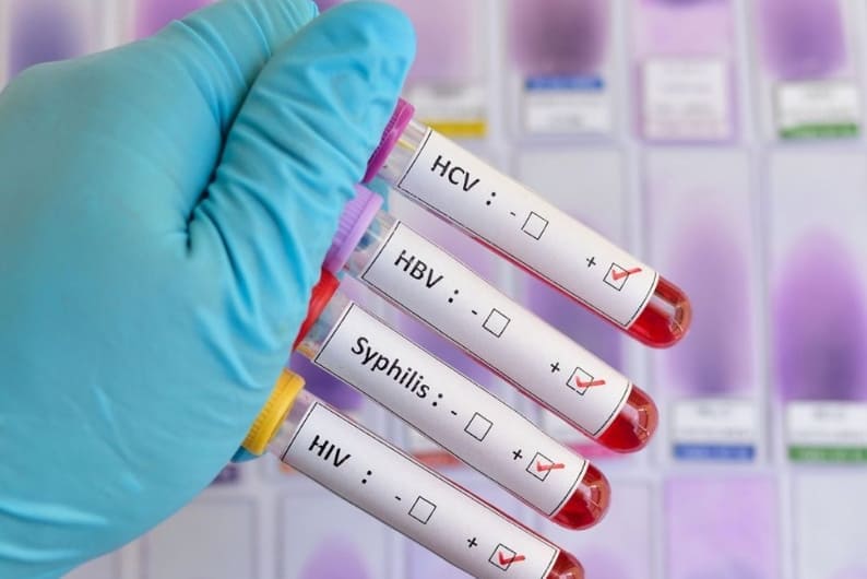 cardiologo para cateterismo